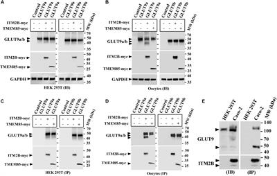 Interaction Between ITM2B and GLUT9 Links Urate Transport to Neurodegenerative Disorders